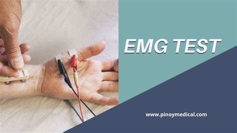 emg-ncv test price philippines|EMG.